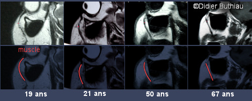 fig12