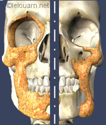 Docteur Le Louarn aesthetic surgeon, face recurve